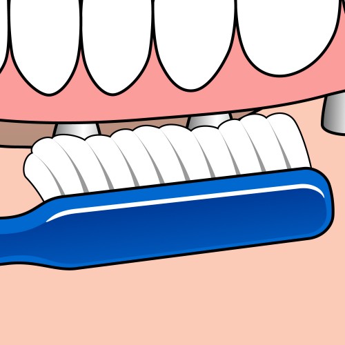 Tepe Diş Fırçası Implant Orthodontic
