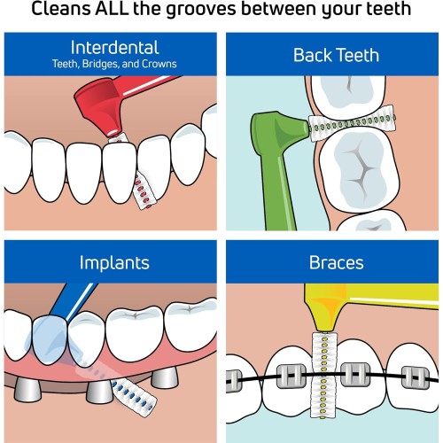 Tepe Daily Diş Macunu 75 ml + Arayüz Fırçası Pembe 0.4 mm 6 lı