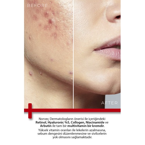 Todays Clinicals Retinol Onarıcı Krem 100 ml