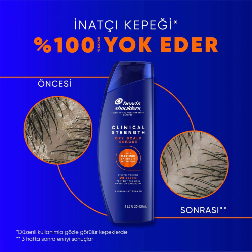 Head & Shoulders Clinical Strength Şampuan 400 ml Head & Shoulders Clinical Strength Şampuan 400 ml